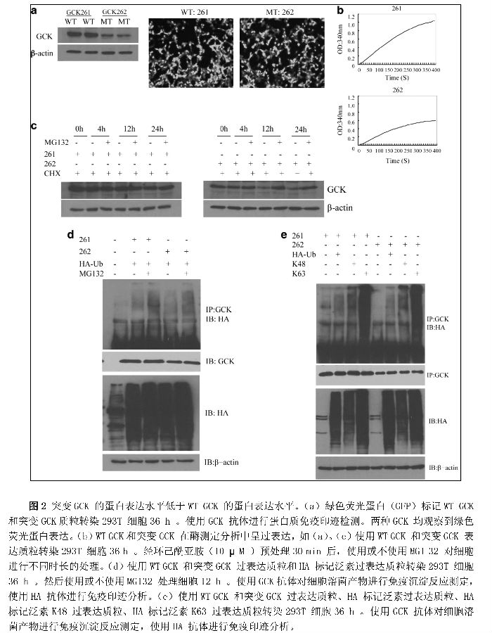 STZ 降低糖尿病鼠模型的GCK 表达水平-2.jpg